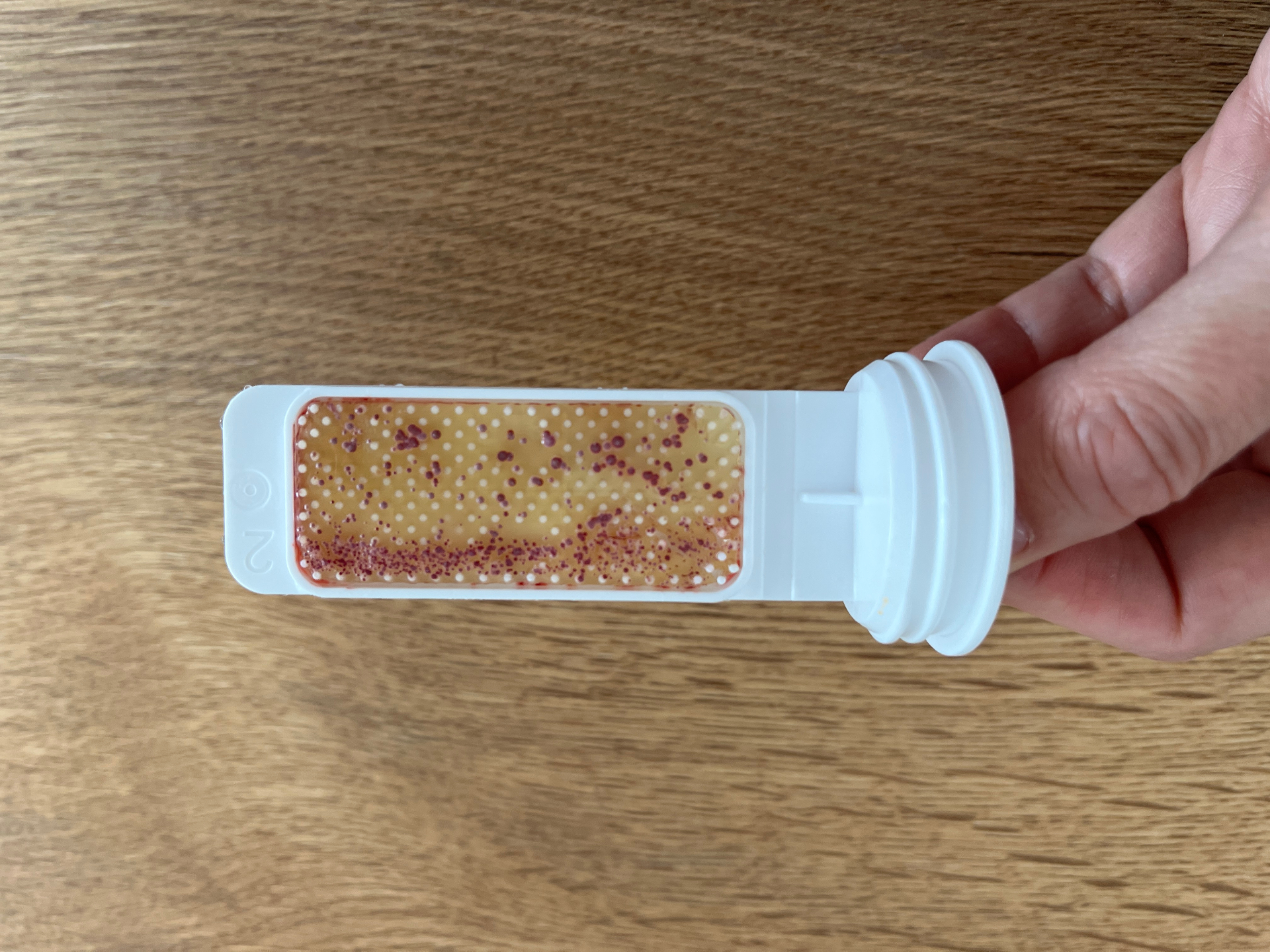 Mikrobiologische Probe vor der Behandlung mit deutlichem Bakterienwachstum